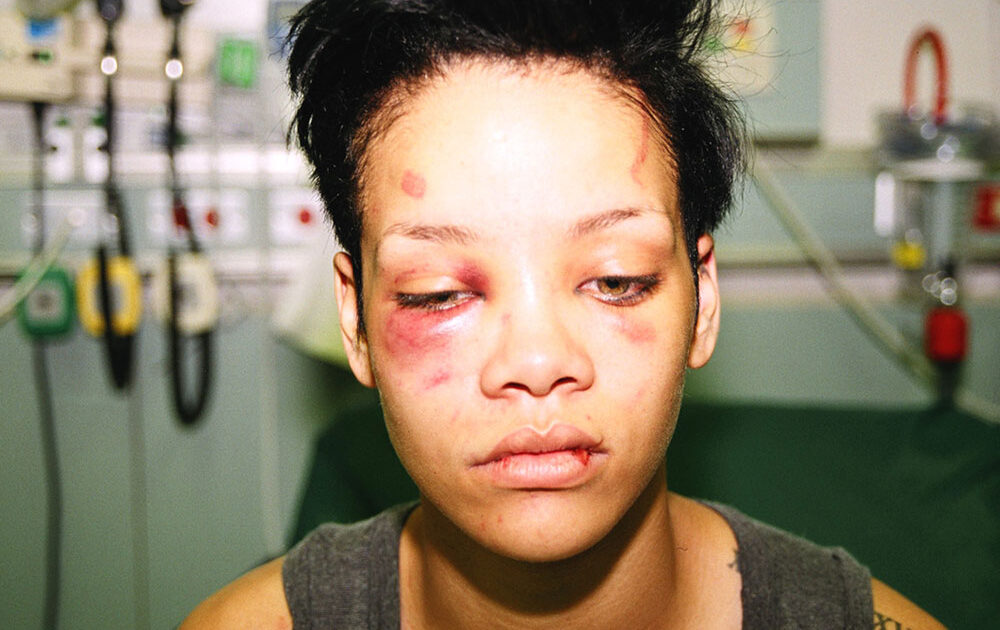 rihanna-face-attack-1000x630.jpg